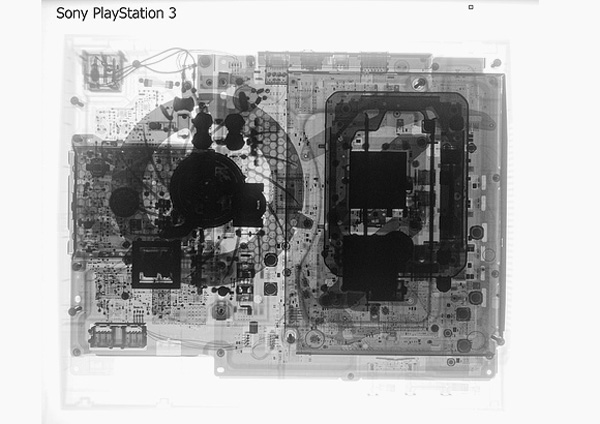 radiografia-ps3